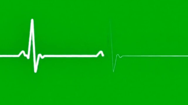 "Looping ECG Waveform Animation on Green Screen | Classic Heartbeat PQRST Rhythm | Medical Cardiology Visual Effect"