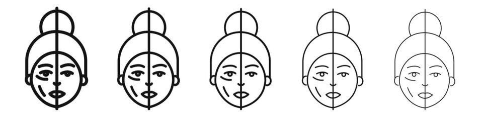 Before and after neurotoxin injection icon vector outline set illustration sign