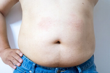 Naklejka premium Obesity man body, fat male belly,close up on white background.highlighting issues of obesity or body weight.