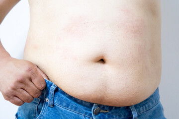 Naklejka premium Obesity man body, fat male belly,close up on white background.highlighting issues of obesity or body weight.