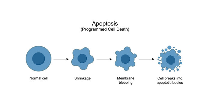 Apoptosis. Programmed cell death. Aging process in cells. Stages of apoptosis, normal cell, shrinkage, membrane blebbing, cell breaks into apoptotic bodies and phagocytosis. Vector illustration. 