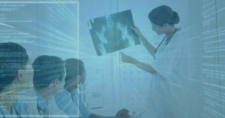 female doctor lifting X-ray in medical briefing, colleagues writing notes as data streams animating - Powered by Adobe