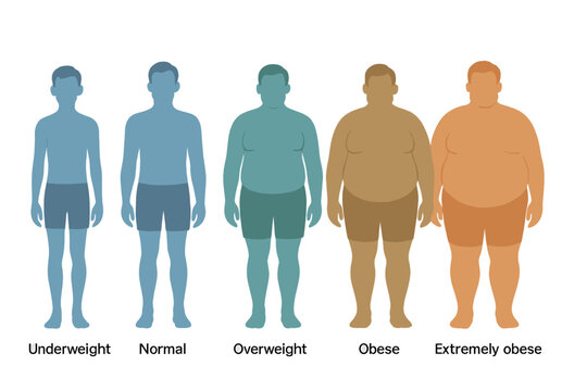 Vector illustration of body mass index ranging from underweight to extremely obese, depicted through male silhouettes with varying obesity levels