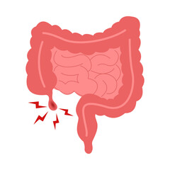 Cartoon of appendicitis symptoms
