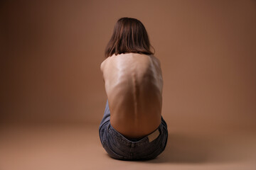 Woman suffering from anorexia on dark beige background, back view