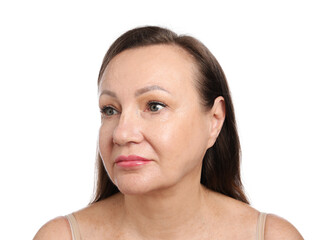 Obraz premium Woman before cosmetic procedure on white background