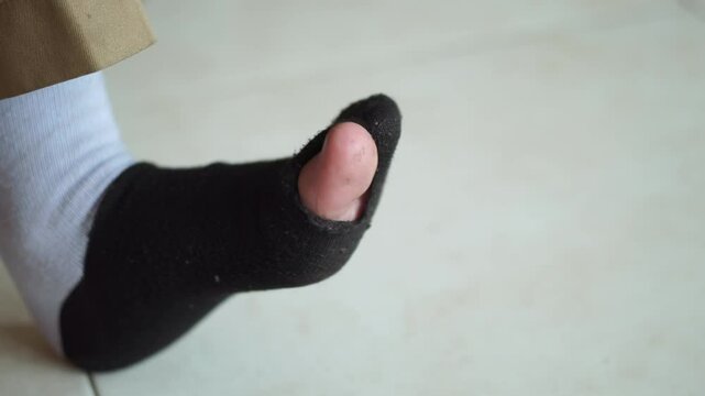 The boy was wearing worn-out school socks with a hole in the big toe. His big toe was visible, sticking out of the sock.