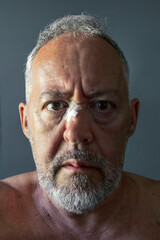 Portrait of a Man with a Bandaged Nose