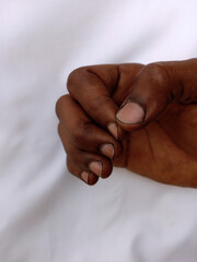 Dirty fingernails of an African woman on white background. Dirt inside short finger nails of black...