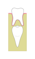 Adult tooth under child tooth in jaw, cross section anatomy. Vector illustration