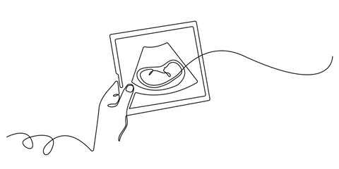 continuous line hand holding ultrasound photo of baby.scan photo of baby in womb.single line illustration.eps 10