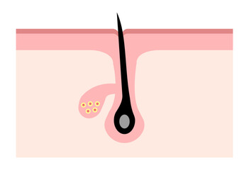 Cross Section of Healthy Skin and Hair Follicle
