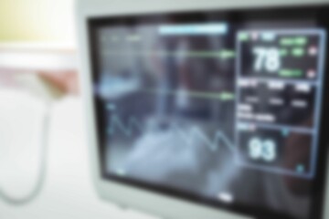 Blurry ECG monitor in hospital