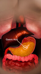 Stomach Pain and Gastric Acid Concept with Anatomical Accuracy for Medical and Academic Reference – 3D Rendering