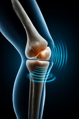 Knee joint is in a state of inflammation