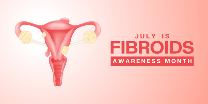 July Is Fibroids Awareness Month. Female reproductive organs. Suitable for posters, banners and social media. White and pink background.