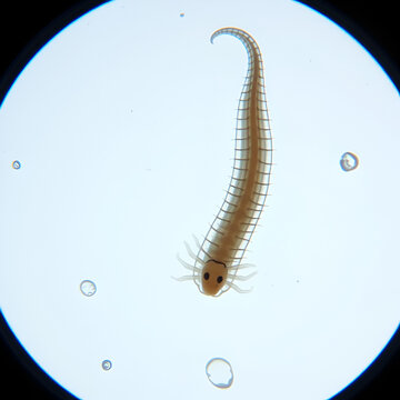 Planarian parasite (flatworm) under microscope view.