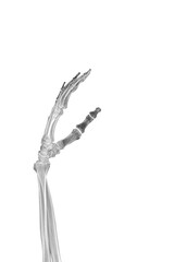 A part of the skeleton is the bones of a human hand, hand and forearm PNG
