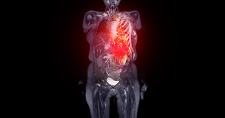 This 3D MRI and CT scan image provides a detailed view of the entire body. The highlighted area shows the thoracic cavity, including the heart and lungs. The vivid color contrast helps emphasize inter