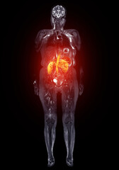 This 3D MRI and CT scan of the whole body highlights the kidneys in vivid orange, providing a detailed view of the internal organs. The scan offers valuable insights for diagnosis .