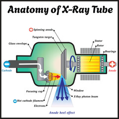 Anatomy of an X-ray Tube