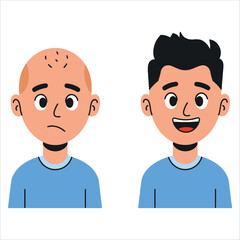 Sad bald man contrasted with happy long haired man vector. Hair loss and treatment concept in flat cartoon style.
