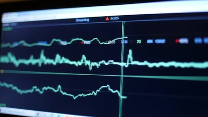 Bandwidth analysis monitor display showcasing real time network data fluctuations - Powered by Adobe