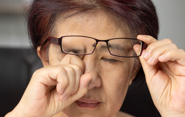 Senior asian woman is periorbital eye fatigue.