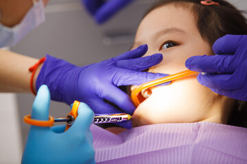 Little Girl Having Teeth Checked by Dentist