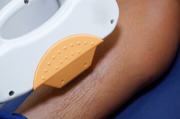 Laser Hair Removal Treatment on Leg Close Up of Device and Skin