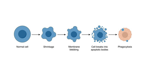 Apoptosis. Programmed cell death. Aging process in cells. Stages of apoptosis, normal cell, shrinkage, membrane blebbing, cell breaks into apoptotic bodies and phagocytosis. Vector illustration.