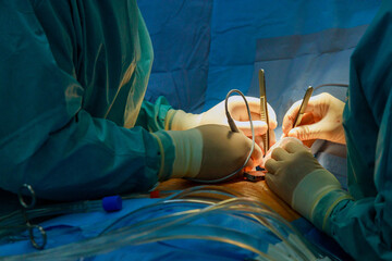 Surgeons intently while performing surgery in hospital operating room serious medical precision...