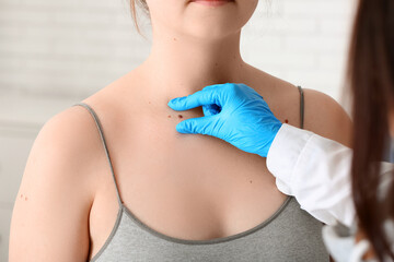 Doctor examining mole of young woman in clinic, closeup