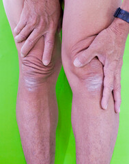 body parts Calluses and rough skin on legs and knees. of the elderly with muscle inflammation and bone degene.