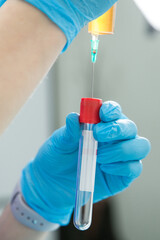 A doctor in gloves fills a test tube with yellow liquid from a syringe. Medical procedure in a...