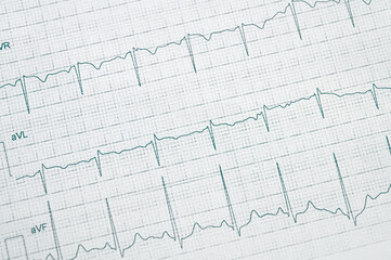 World Heart Rhythm Week concept. Electrocardiogram graph on paper.