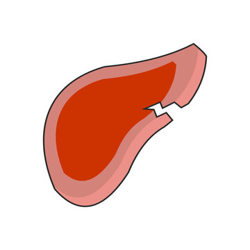 epigastrium disease illustration