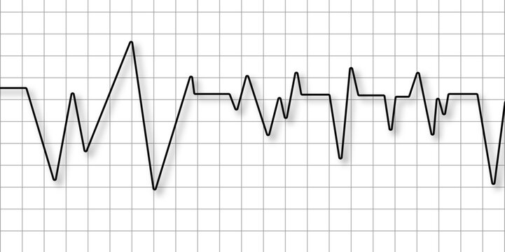 Heart disease cardiogram. Increasing amplitude pulse rate, sawtooth wave, increasing amplitude wave. Heart pulse monitor with signal. Electrocardiogram. Medical healthcare symbol. vector.             