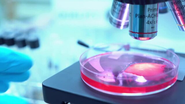 A pathologist studies diseased tissue under a microscope, diagnosing diseases such as tuberculosis and helping guide a patient's treatment plan.