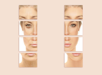 Signs of skin aging,signs of premature aging,
Wrinkles and fine lines,Age spots,Sagging...