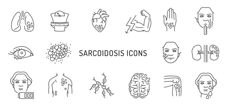 Sarcoidosis icons set in black color. Editable vector - Powered by Adobe