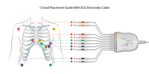 12 lead electrocardiograph placement guide