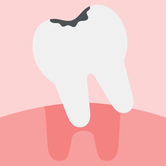Decayed tooth loss on a pink background.