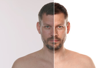 Portrait of man before and after retouching on white background
