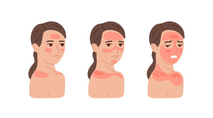 Obraz premium Woman with different levels sunburn and red skin. Sun protection concept for summer safety. Skin care and health problems. Flat vector illustration