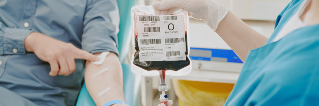 Caucasian middle aged man donating blood while medical professional wearing gloves holding blood bag and monitoring transfusion process in clinical setting - Powered by Adobe