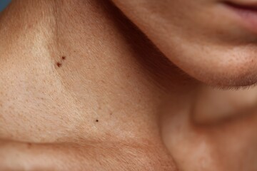 Male neck with visible texture and hair, showing natural imperfections and signs of aging on skin, photographed indoors, perfect for healthcare visuals, skin condition references, or beauty ads.