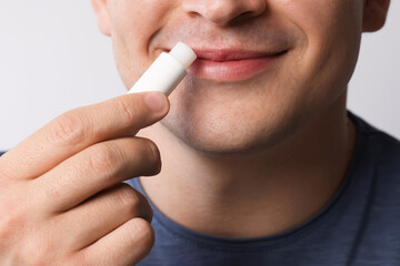 Young man applying lip balm onto his lips on light grey background, closeup