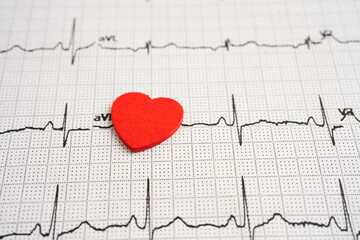 Electrocardiogram ECG heart wave, heart attack, cardiogram report.