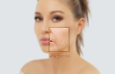 Signs of skin aging,signs of premature aging, Wrinkles and fine lines,Age spots,Sagging skin,Dehydrated skin,eyelid area